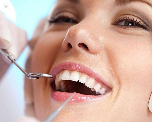 Holistic Dentist Tampa