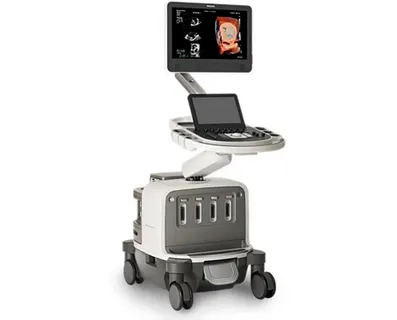 Philips ultrasound machine